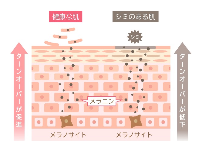 UVケア肌断面図
